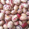 Light  speckle kidney beans