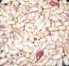 LSKB kidney bean