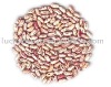 Light speckled kidney beans