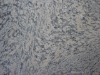 Tiger Rusty Yellow Granite